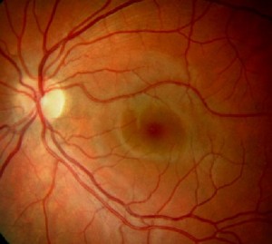 Blood flows to the retina (which is made of nerves) through arteries and veins.